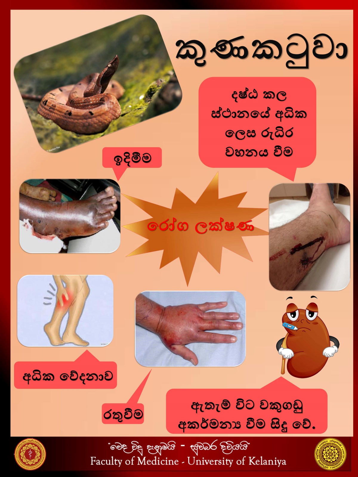 http://medicine.kln.ac.lk/vedavidudanuma/images/gallery/Trauma_Zone/Toxicology/kunakatuwa_001.jpg
