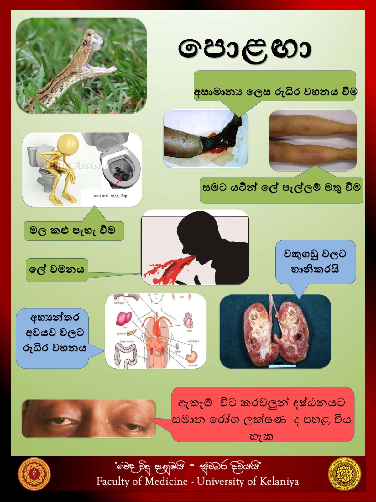 http://medicine.kln.ac.lk/vedavidudanuma/images/gallery/Trauma_Zone/Toxicology/viper_001.jpg